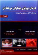درمان پروتزی بیماران بی دندان ۲۰۱۳ ( بوچر – زارب )