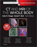 CT And MRI Of The Whole Body – 3 Vol ...