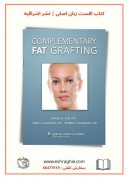 Complementary Fat Grafting 1st Edition