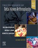 The Technique Of Total Knee Arthroplasty 2022