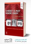 Chest X-Ray Made Easy 2022