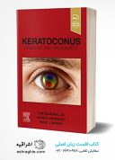 Keratoconus: Diagnosis And Management 1st Edition