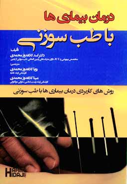 درمان بیماریها با طب سوزنی