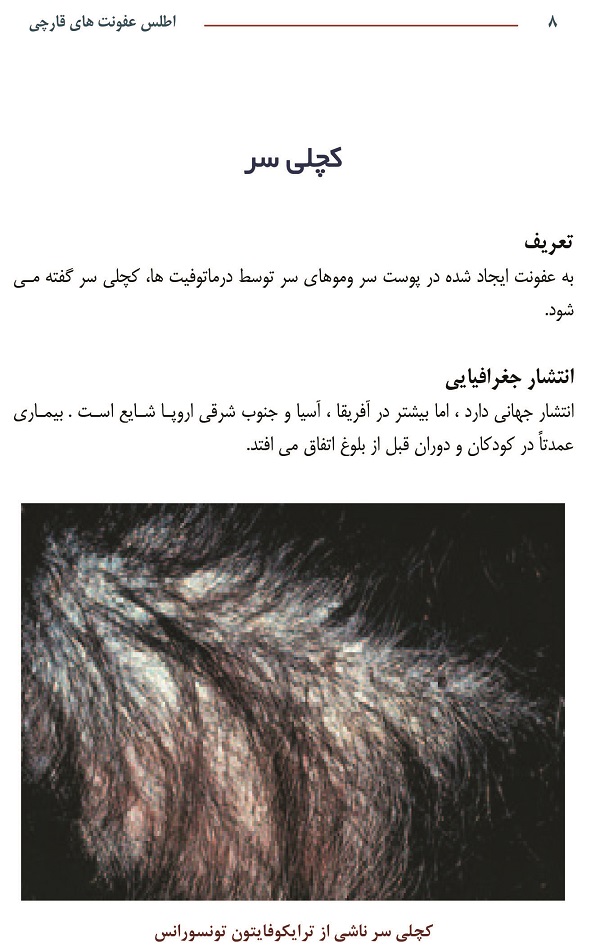 اطلس عفونت های قارچی - رنگی - Image 5