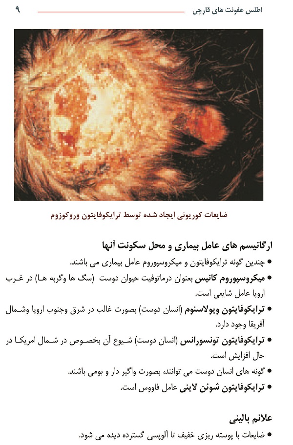 اطلس عفونت های قارچی - رنگی - Image 6