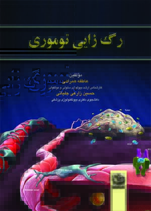 رگ زایی توموری