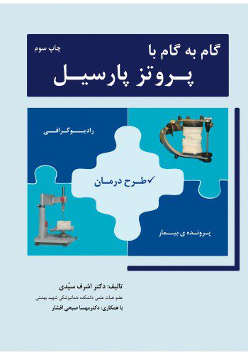 گام به گام با پروتز پارسیل  ترجمه کتاب Step by Step with Removable Partial Denture