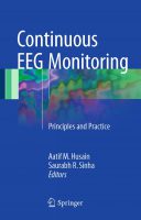 Continuous EEG Monitoring: Principles & Practice