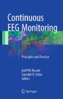 Continuous EEG Monitoring: Principles & Practice