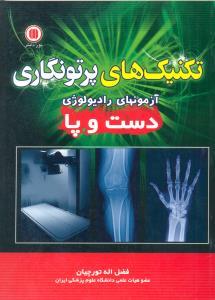 تکنیک های پرتو نگاری تورچیان (آزمون های رادیولوژی دست و پا)