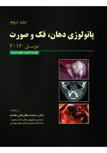 پاتولوژی دهان و فک و صورت نویل ۲۰۱۶ | جلد 2