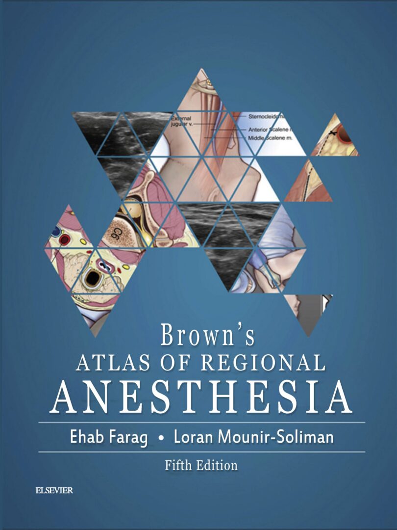 Brown's Atlas of Regional Anesthesia