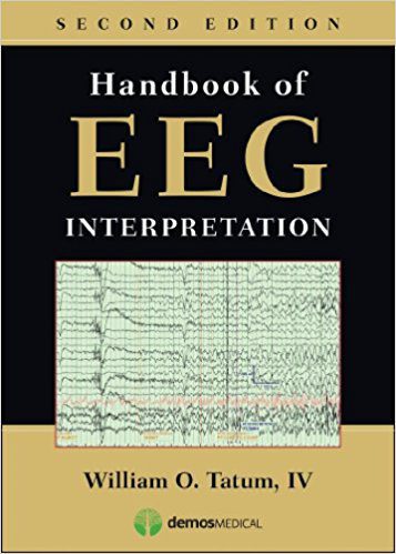 Handbook of EEG Interpretation