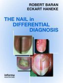 The Nail In Differential Diagnosis
