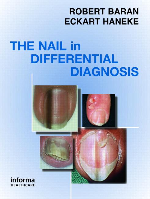 The Nail in Differential Diagnosis