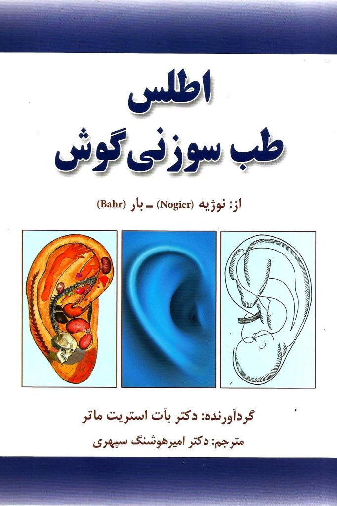 اطلس طب سوزنی گوش - نوژیه - Nogier