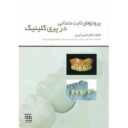 پروتزهای ثابت دندانی در پری کلینیک
