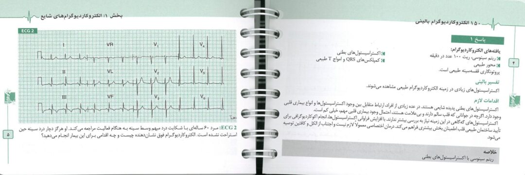 150 مسئله الکتروکاردیوگرافی ECG