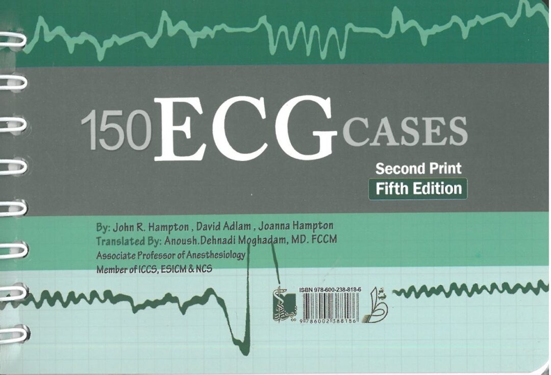 150 مسئله الکتروکاردیوگرافی ECG