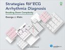 Strategies For ECG Arrhythmia Diagnosis