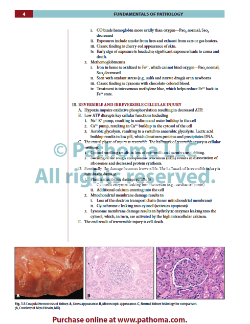 Fundamentals of Pathology sattar - پاتولوژی ستار پاتوما 2022