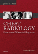 Chest Radiology: Patterns And Differential Diagnoses