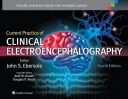 Current Practice Of Clinical Electroencephalography