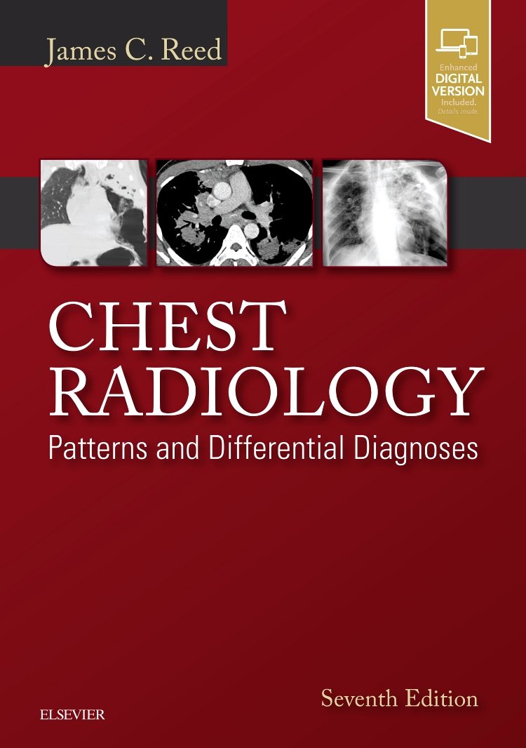 chest radiology diagnoses