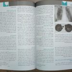نمونه اصول طب داخلی هاریسون 2022 - تنفس ( بیماری های ریه و مراقب های ویژه )