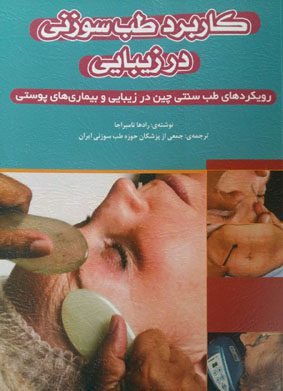 کاربرد طب سوزنی در زیبایی - رویکردهای طب سنتی چین