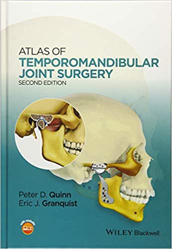 Atlas of Temporomandibular Joint Surgery - 2015