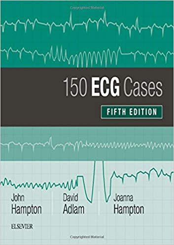 ECG Cases (150 ECG Problems) 2019 - الکتروکاردیوگرام