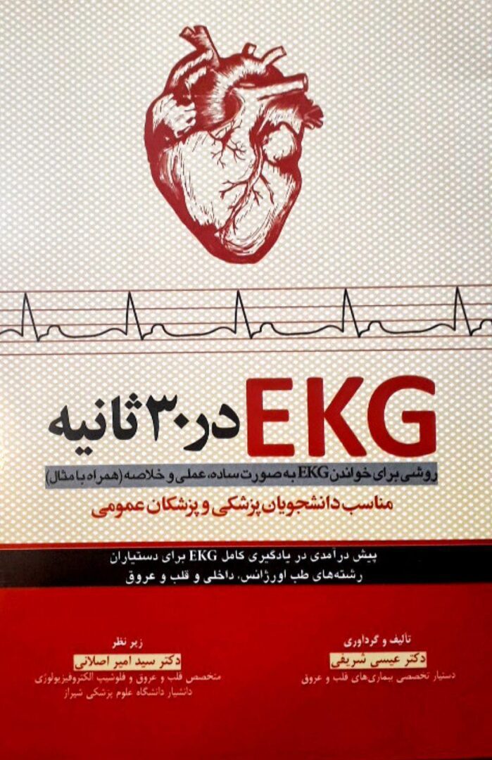 EKG در 30 ثانیه