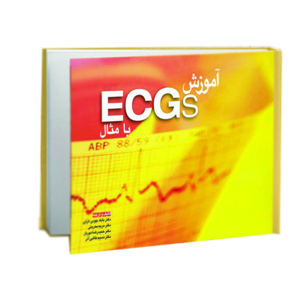 آموزش ECG با مثال