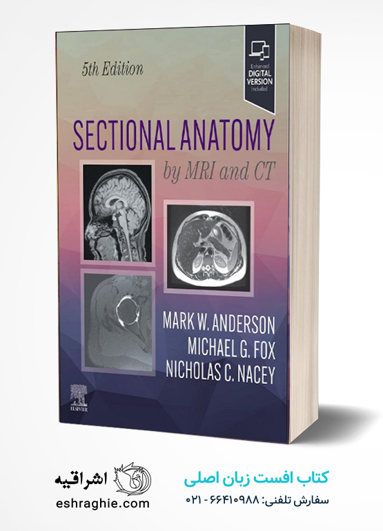 Sectional Anatomy by MRI and CT