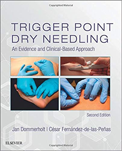 Trigger Point Dry Needling: An Evidence and Clinical-Based Approach - 2019