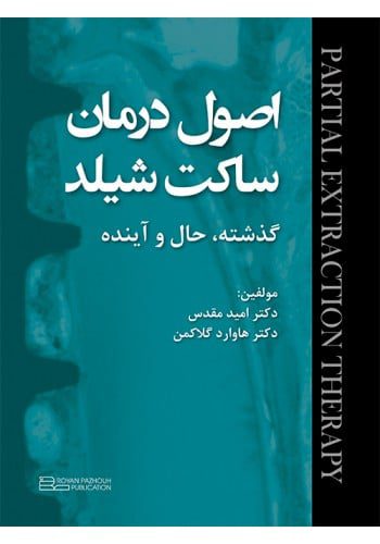 اصول درمان ساکت شیلد ؛ گذشته ، حال و آینده