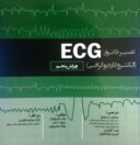 تفسیر ۱۵۰ نوار ECG – الکتروکاردیوگرافی ۲۰۱۹