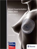 Breast Augmentation Video Atlas – 2019