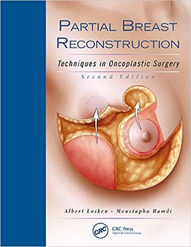 کتاب انکوپلاستی - جراحی پستان - تکنیک ها - اشراقیه - افست - 2018
