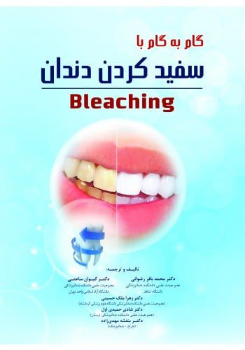 گام به گام با سفید کردن دندان (Bleaching)
