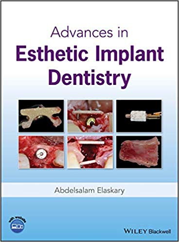 Advances in Esthetic Implant Dentistry - 2019