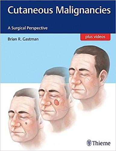 Cutaneous Malignancies: A Surgical Perspective - 2017