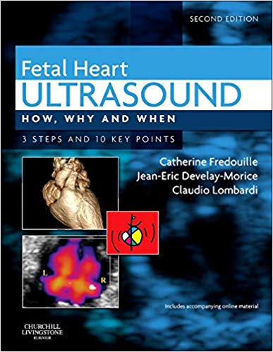 Fetal Heart Ultrasound : How, Why and When - 2014Fetal Heart Ultrasound : How, Why and When - 2014