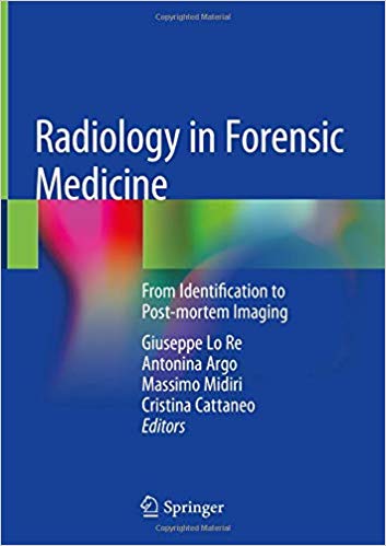 رادیولوژی در پزشکی قانونی: از شناسایی تا تصویربرداری پس از مرگ