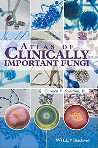 Atlas of Clinically Important Fungi 2018
