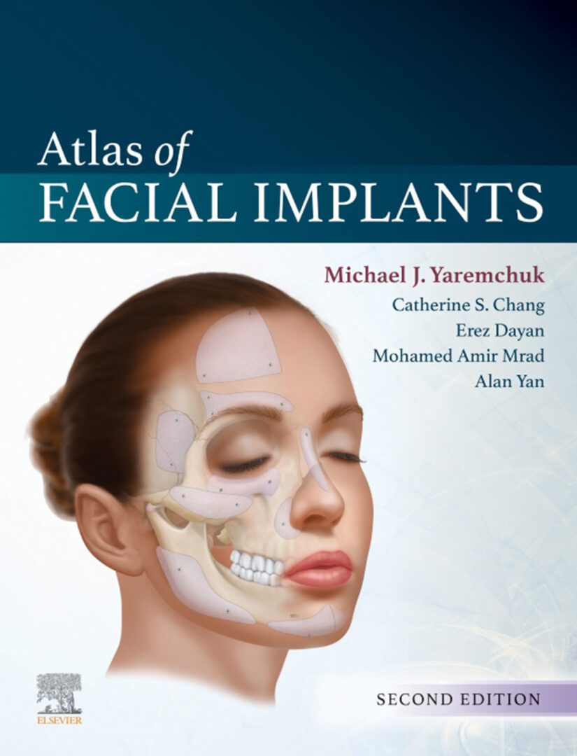 Atlas of Facial Implants- 2019