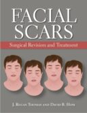 Facial Scars: Surgical Revision And Treatment – 2019