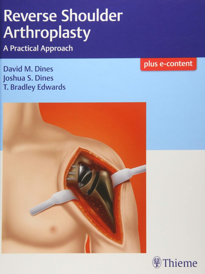 Reverse Shoulder Arthroplasty - A Practical Approach - 2018