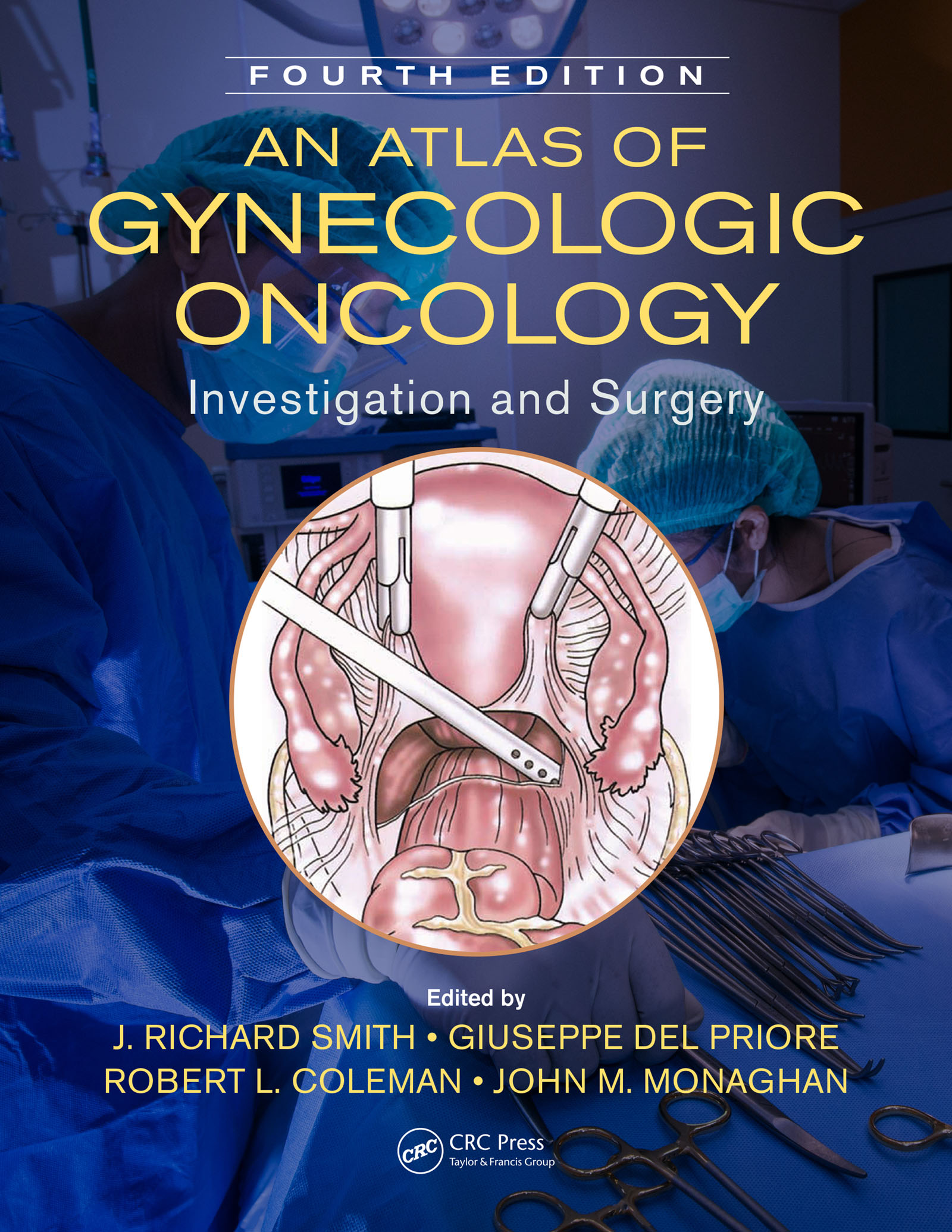 An Atlas of Gynecologic Oncology - Investigation and Surgery - خرید کتاب افست جراحی زنان اشراقیه